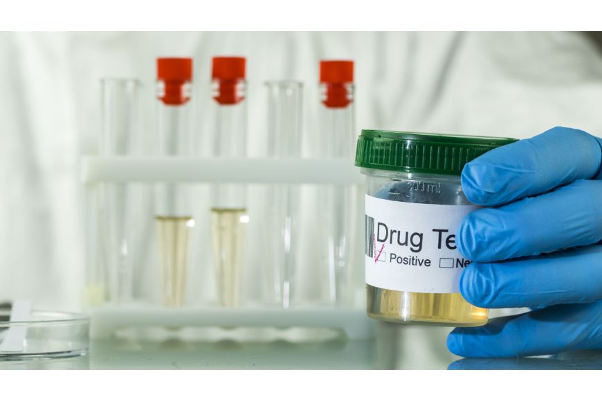 10 Medications That Can Cause False Positive Drug Tests | America’s Pharmacy