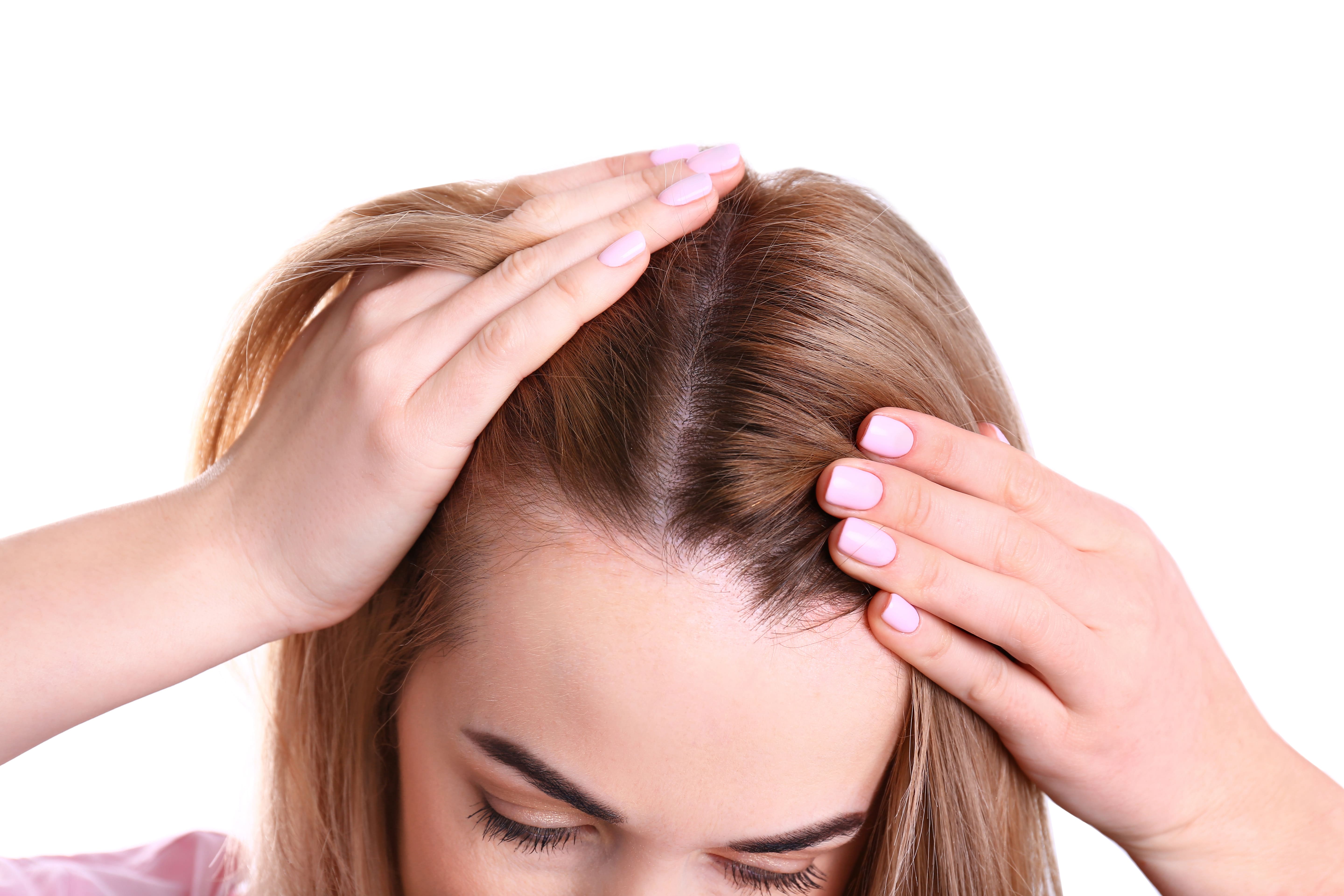 Drugs That Cause Hair Loss in Women Too | America's Pharmacy
